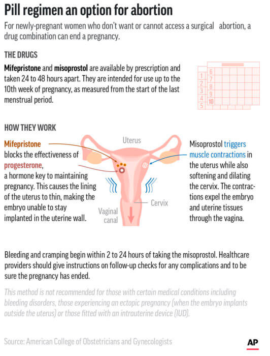 Medication abortion is common; here’s how it works | amNewYork