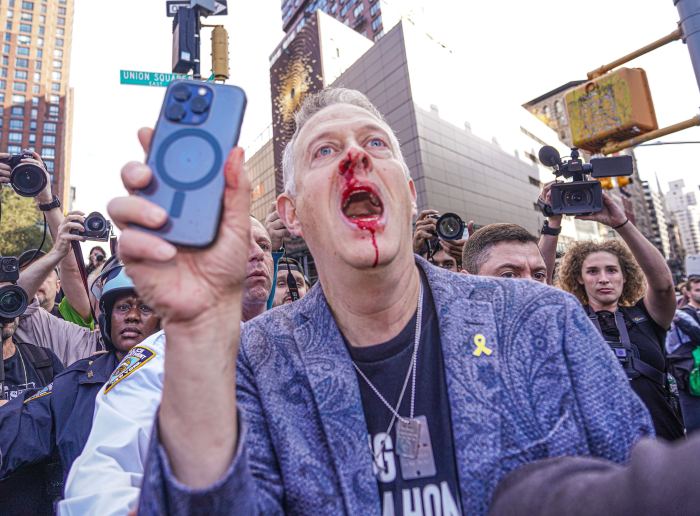 The pro-Israel protester bloodied following the confrontation.